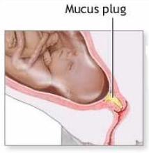 як виходить пробка при вагітності перед пологами