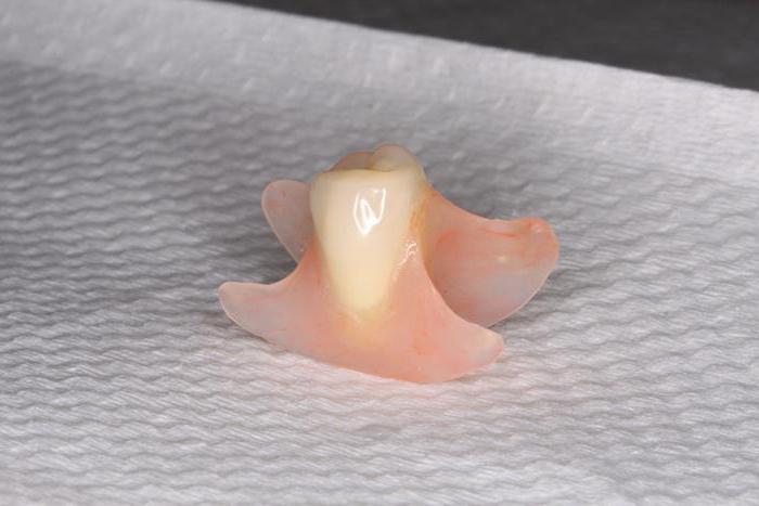 Варіанти заміни зубів. стоматологічне протезування